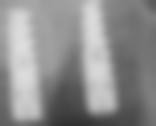 种植牙术前术后避坑指南（香港人生活习惯版）