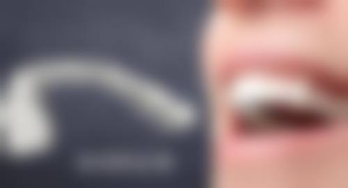 香港 澳门哪个牙科更好:术前术后避坑指南