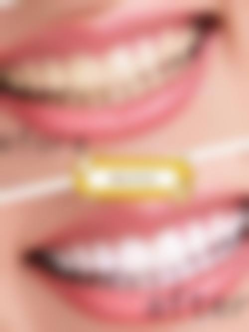 十一、贺兰县伶俐口腔诊所真人口碑实例评价一览