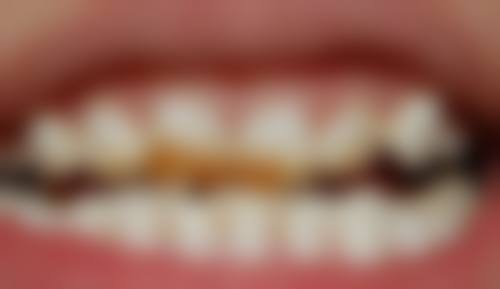 香港牙醫推薦 價錢範圍（HKD）