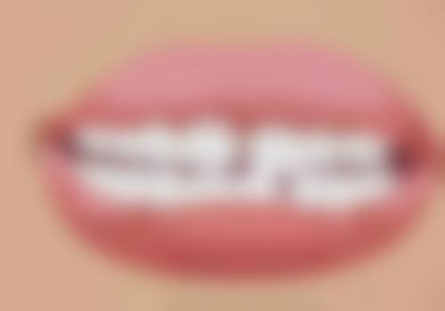 香港牙醫推薦 vs 深圳口岸：邊度平啲？