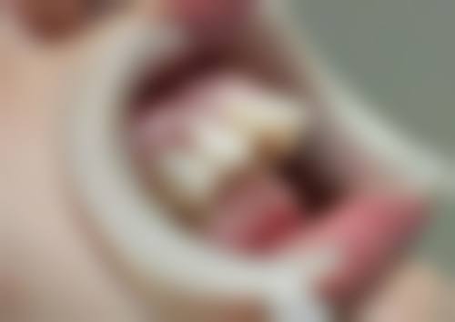 香港牙醫推薦 必備牙膏推介