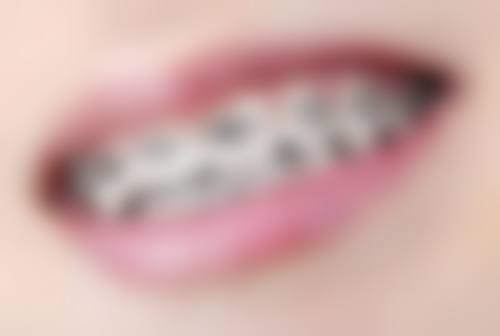 香港 澳门去珠海拱北口岸牙科医院路线 适合边类人群?3类香港姊妹更啱