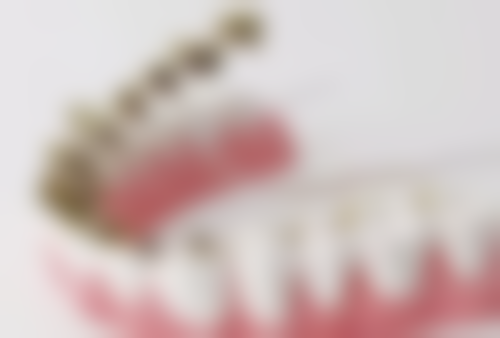 香港 澳门去珠海拱北口岸牙科医院路线 价钱对比:平过香港一半?实测数据话你知