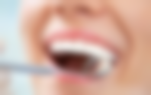 香港 格倫菲爾口腔lihkg 價錢大比拼:種牙矯正真係慳50%?