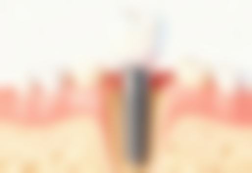 拓展延伸:格倫菲爾口腔lihkg 項目真相+避坑指南