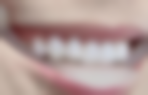 理性提醒：北上睇牙雖平，但安心第一！