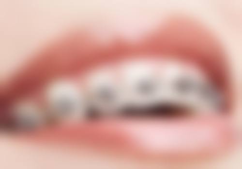 6、云南昆明竹子口腔口碑好评反馈