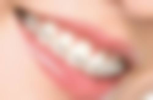 港人北上睇牙實錄：3個真實实例話你知值唔值