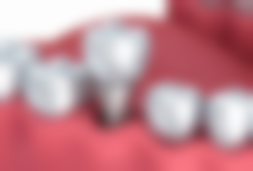 香港 深圳牙科醫院哪家好？：国有vs民营点拣？适合人群大不同