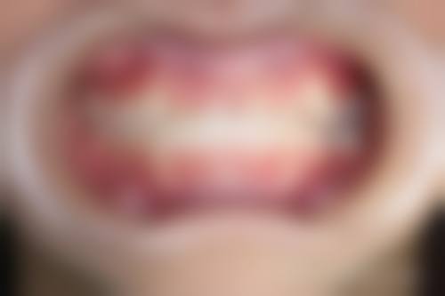 选医攻略：香港人去深圳睇牙必做5步