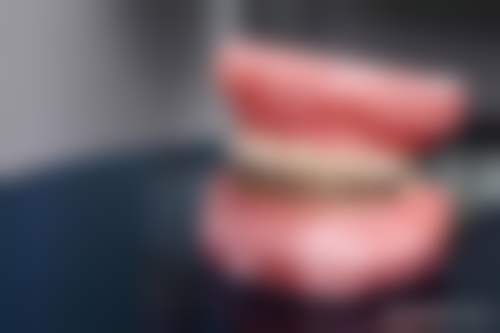 2、儿童补牙反复脱落的应对方案