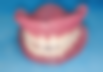 香港良心牙醫推薦 價錢範圍(HKD)+ 深圳口岸對比