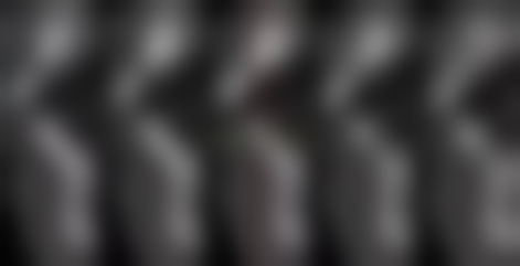 理性提醒：種牙係「長期投資」，安心永遠排第一