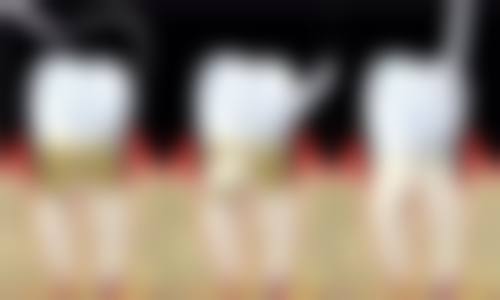 香港人去澳门睇牙科懒人攻略:交通+预约+一日游