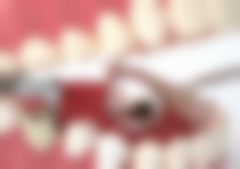 澳门牙科项目真相:香港人更关心嘅3个问题