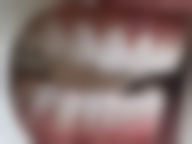 香港 澳门牙科收费价目表 适合边类人群？唔系个个都啱去澳门！