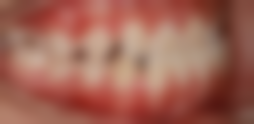 香港 澳门牙医哪家好 价钱范围(HKD)