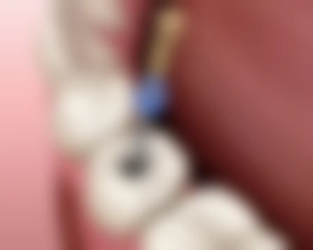 三、徐卫东医生做手术价格：