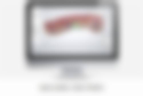 allon4植牙費用香港2026｜一文睇清港大/私家醫院收費+種牙市場行情分析