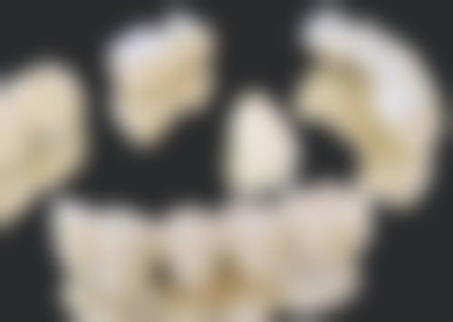 香港 香港箍牙必睇 適合邊類人群？3類人更啱北上箍牙