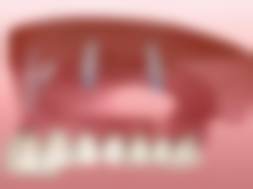 深圳格伦菲尔口腔医院(宝安宝中院区)