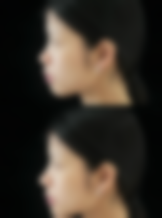 五| 深圳格伦菲尔牙科口腔收费标准