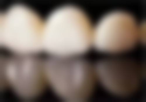 十四、江西上饶美维阳光口腔患者常见问答