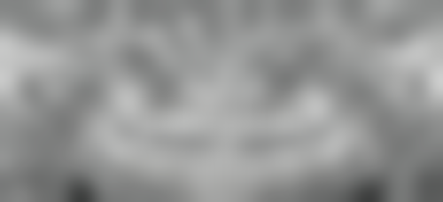 香港 大睦看牙醫費用：術前術後避坑指南（附香港生活習慣）