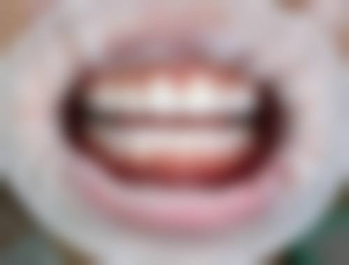 重庆渝北何鹏口腔医院24小时电话服务