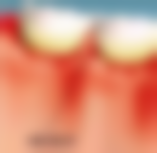 香港睇牙醫幾錢 vs 深圳珠海：價錢差8倍？真實對比