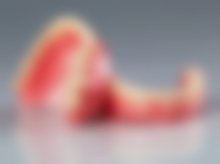 理性提醒：整牙千祈唔好貪平！