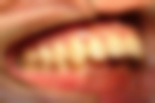 澳門看牙醫貴嗎：診所揀選3大要點（避坑必看）