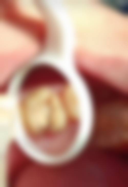 珠海拱北看牙術前術後避坑指南（香港人生活習慣版）