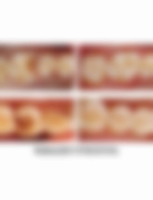 珠海拱北牙科哪家好一点 3間平靚正推介（附香港人真實实例）