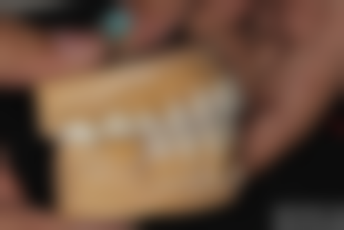 珠海拱北牙科哪家好一点 種植牙/正畸/牙周炎收費對比（港幣參考）