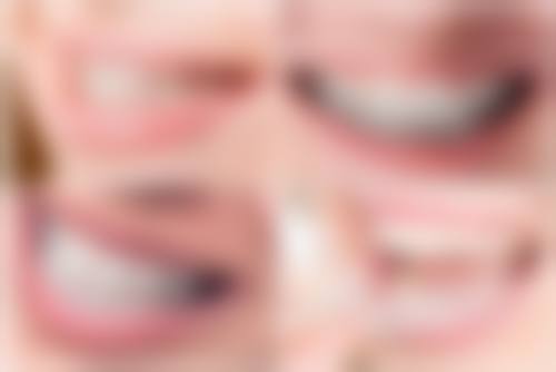 术后修复