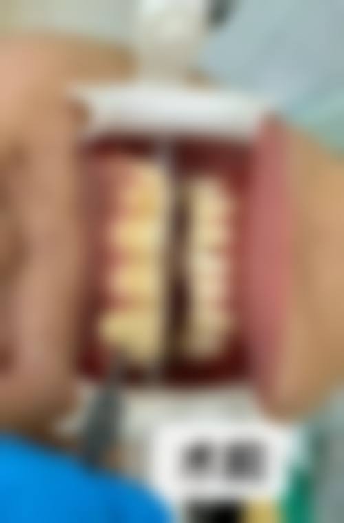 二、湘潭县乐健口腔重点口腔诊疗项目