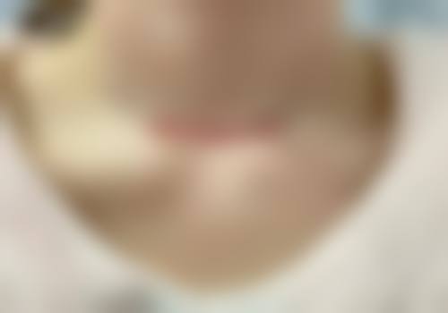 四、上海沃德医疗中 心医疗美容科正规靠谱吗
