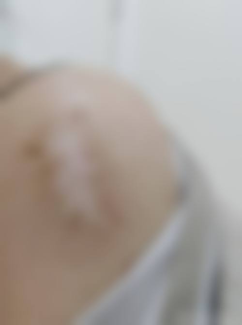 哈尔滨亿嘉医疗美容门诊部患者常见问题解答（精选 ）
