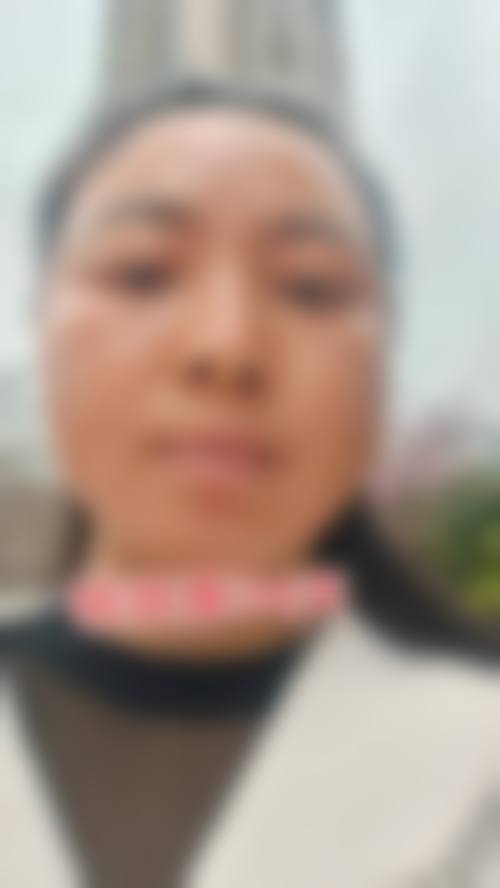 八、患者常见问题解答（精选 ）