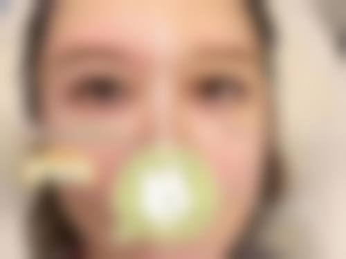 十一、哈尔滨优漾医疗美容门诊部真人口碑实例评价一览
