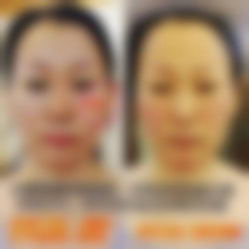 五、哈尔滨美佰玥医疗美容门诊部价格表区间/收费标准说明