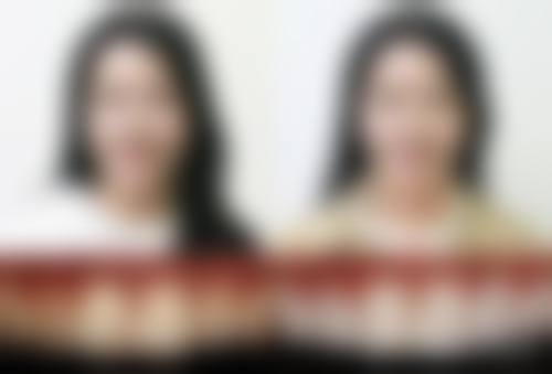 十一、抚州佰诺口腔门诊部真人口碑实例评价一览
