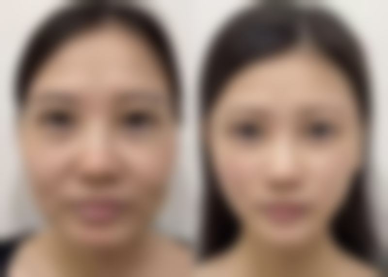 黑龙江中航医院腋臭科医生介绍