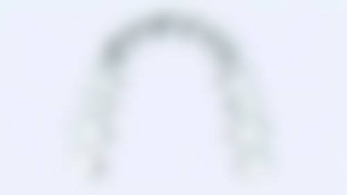拓展延伸:种牙项目真相+关键选择点+避坑指南