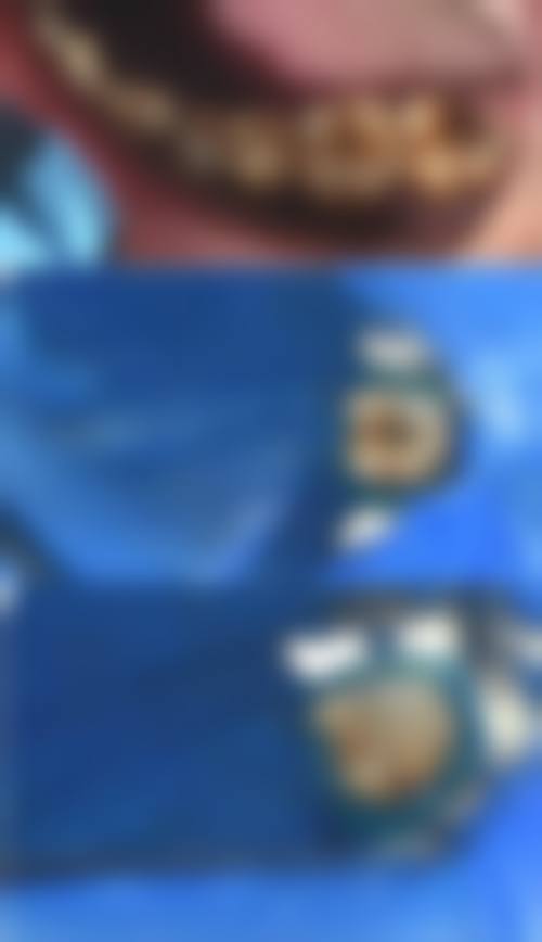 王晓医生擅长项目