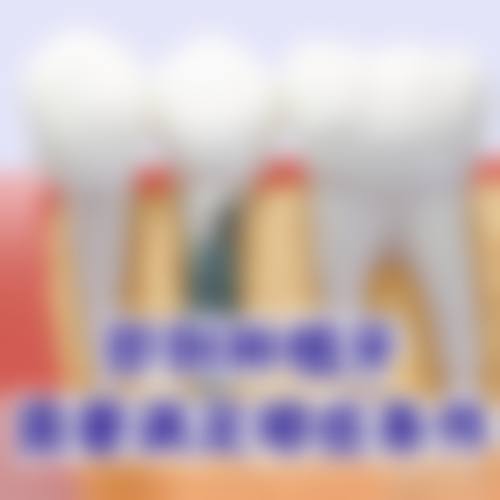 深圳即刻種牙邊間好 項目真相:港澳姊妹更常問3個問題!