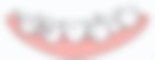 深圳隱形牙套價錢2026:熱門診所比拼