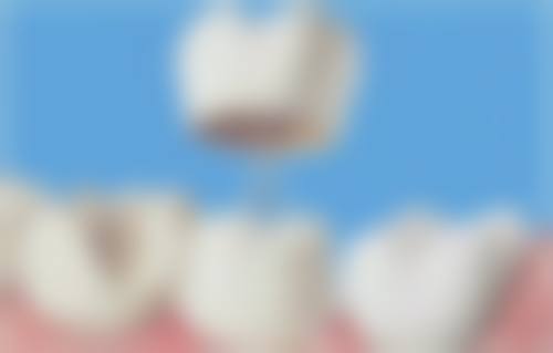 理性提醒